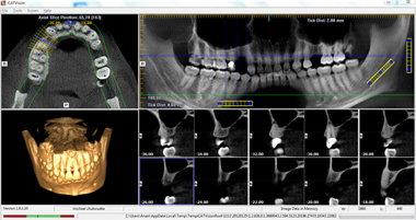  Digital Dental CT-Scan (Digital Radiography)