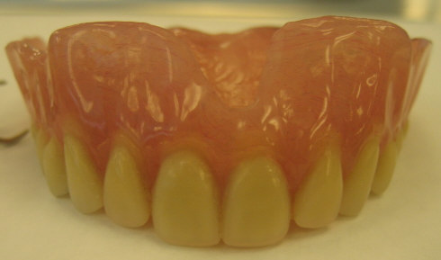 Maxilary Denture